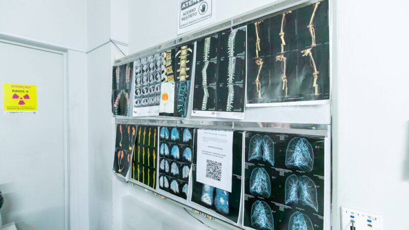 Cuiabá instala ressonância magnética de última geração no São Benedito